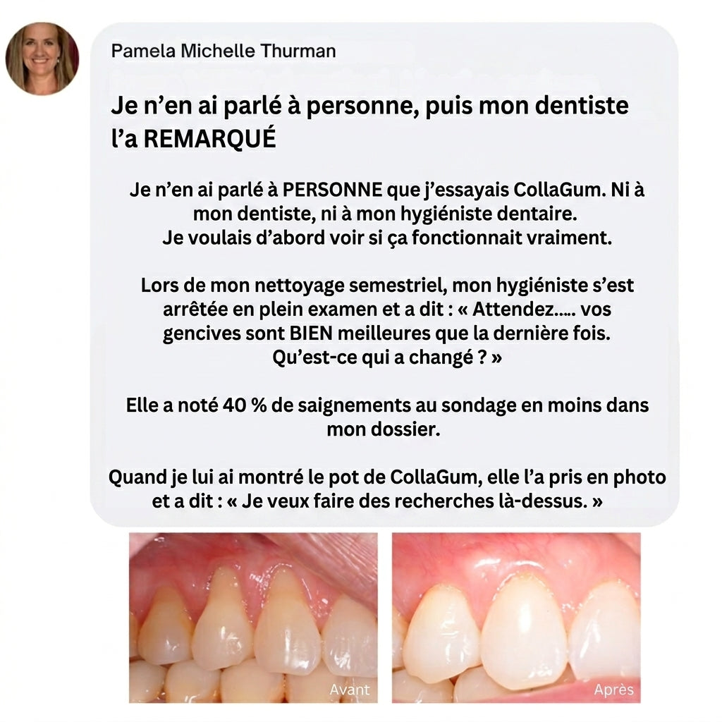 Collagène Marin Gingival & Citrate de Zinc — Soin Naturel des Gencives
