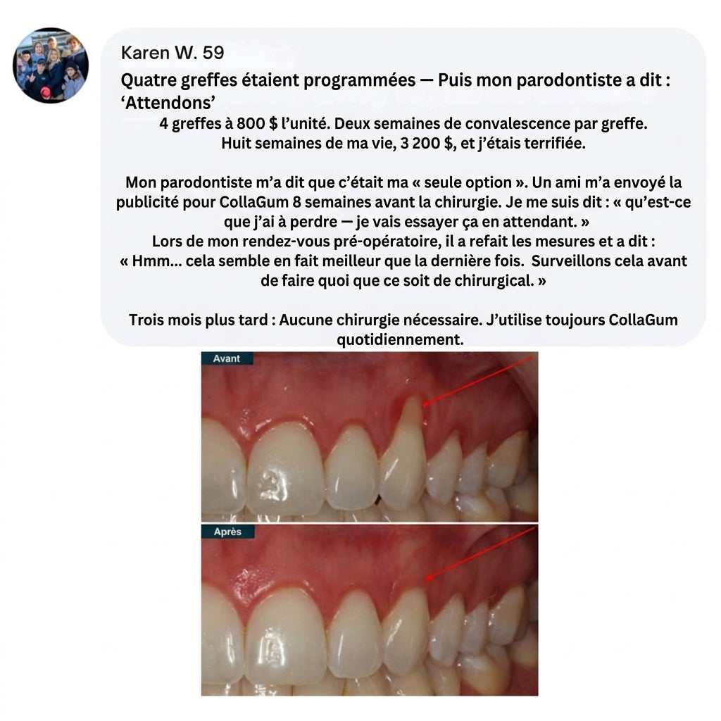 Collagène Marin Gingival & Citrate de Zinc — Soin Naturel des Gencives