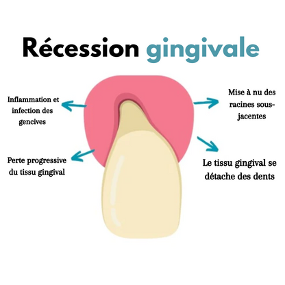 DentiZen™ - Gel de thérapie gingivale