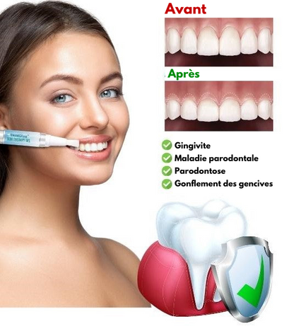 DentiZen™ - Gel de thérapie gingivale