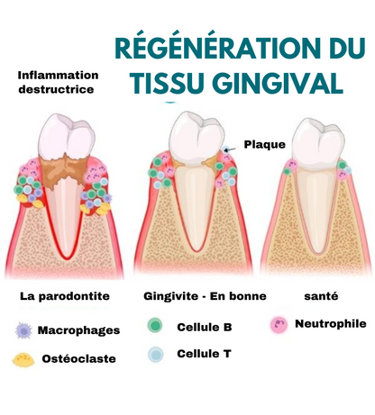 DentiZen™ - Gel de thérapie gingivale