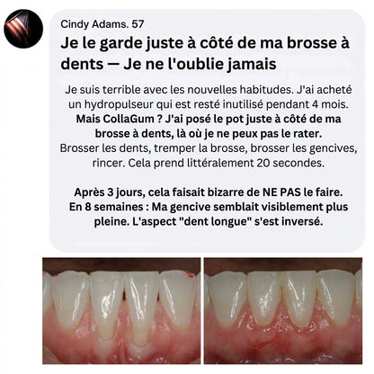 Collagène Marin Gingival & Citrate de Zinc — Soin Naturel des Gencives